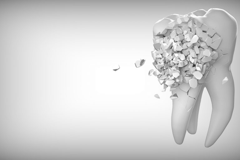 Zahnzusatzversicherungen